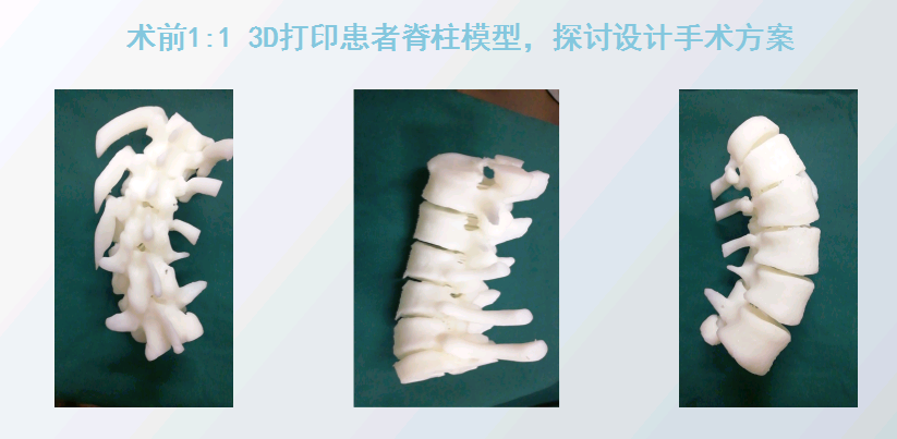 上海數(shù)造攜手安徽省二院骨三科專家章玉冰主任 開展3D打印醫(yī)療骨科應(yīng)用在線講堂